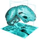 BigBrain Logo