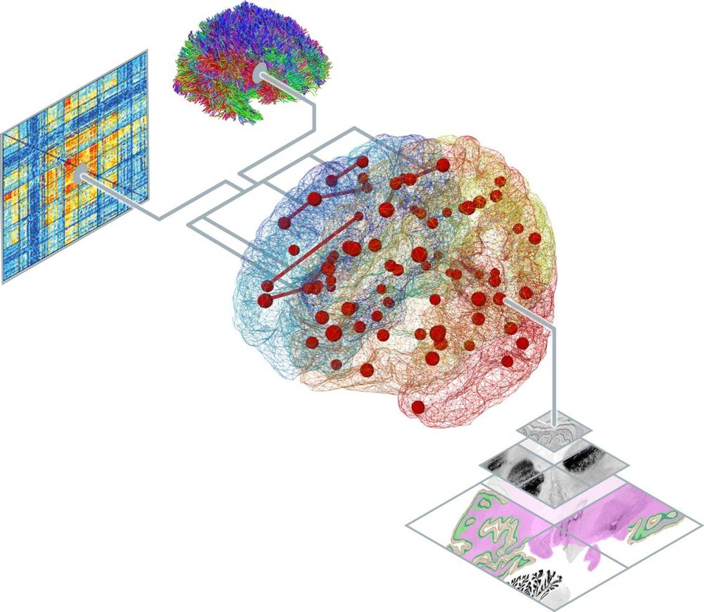 The Virtual Brain Ebrains The Virtual Brain Ebrains